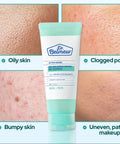 Dr. Belmer cream tube with skin issues on a light blue background