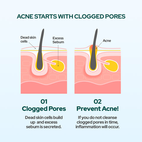 Dr. Belmeur AHA BHA Sebum Control Gel Cleanser 100ml - For Oily Skin