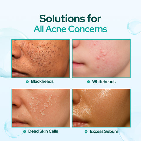 مسحة التقشير من دكتور بيلمور AHA PHA